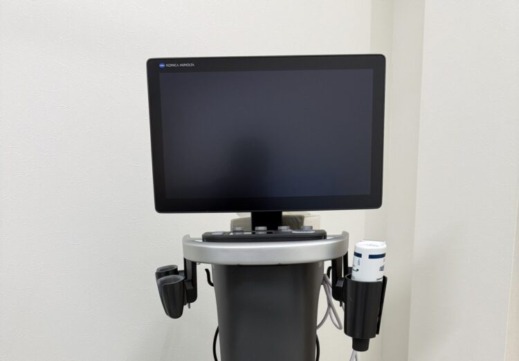 超音波診断装置（エコー）